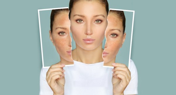 Quanto è importante una buona skincare?