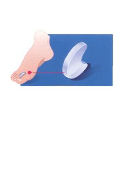 PODOGEL DIVARICATORE M 1PZ PODOGEL DIVARICATORE M 1PZ