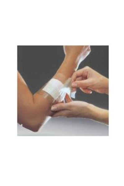 OPSITE FLEXIFIX 15X1000 1PZ 375 OPSITE FLEXIFIX 15X1000 1PZ 375